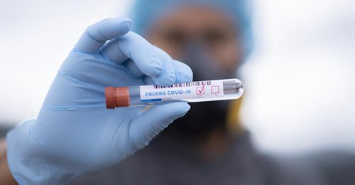 new-study-supports-rapid-testing-for-a-risk-free-restart-of-air-travel
